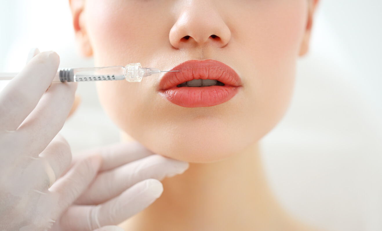Are You a Candidate For Lip Fillers in Bolton